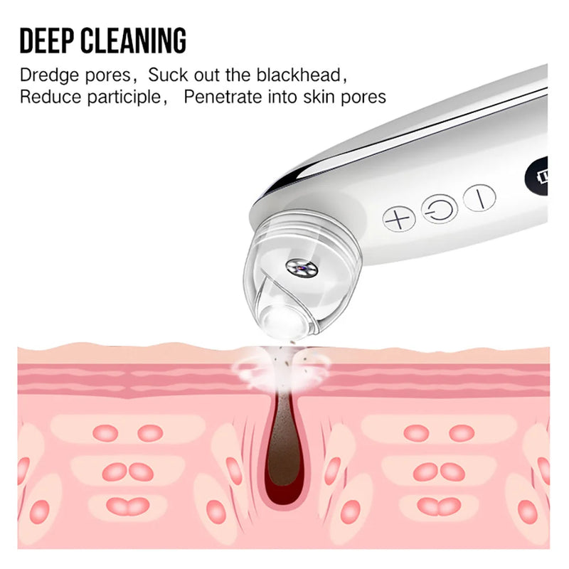 Facial Blackhead Remover for Deep Pore Care – eye, eyes, seal (Image 2)