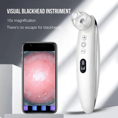 Facial Blackhead Remover for Deep Pore Care – eye, eyes, seal (Image 7)