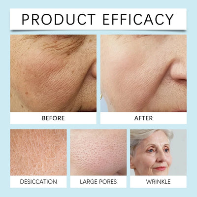 Full Face Exfoliating Mask – Deep Cleansing & Brightening – helmet, furrow, furrowed (Image 4)
