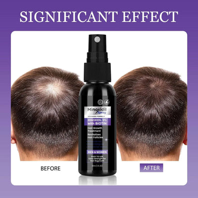Hair Care Nourishing – Supple Scalp Treatment – pack, haircare, tease (Image 3)
