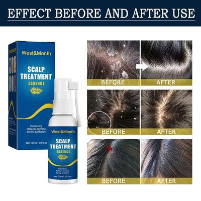 Hair Root Care Spray – for Follicle Repair & Growth – set, gel, rinse (Image 2)