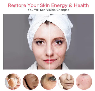 Ion Beauty Device – Skin Firming & Deep Cleansing Facial Tool – pacemaker, kalon, blower (Image 6)