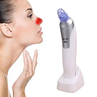 Electronic Blackhead Remover for Clear Skin – knot, pacemaker, deacon (Image 6)