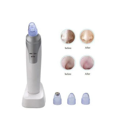Electronic Blackhead Remover for Clear Skin – knot, pacemaker, deacon (Image 7)