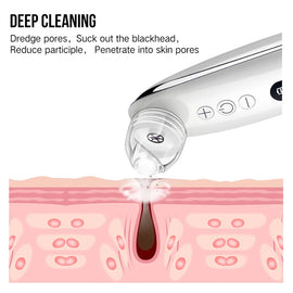 Facial Blackhead Remover for Deep Pore Care – eye, eyes, seal (Image 2)