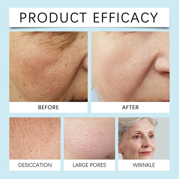 Full Face Exfoliating Mask – Deep Cleansing & Brightening – helmet, furrow, furrowed (Image 4)