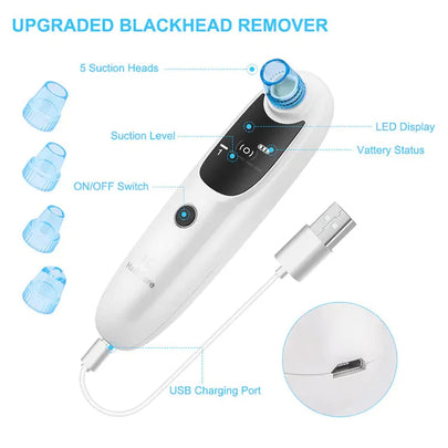 Blackhead Remover – Electric Pore Vacuum Cleaner for Deep Facial Care – iron, eye, soft (Image 1)