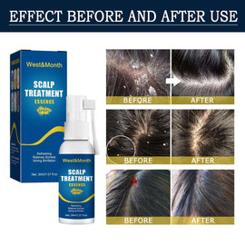 Hair Root Care Spray – for Follicle Repair & Growth – set, gel, rinse (Image 2)
